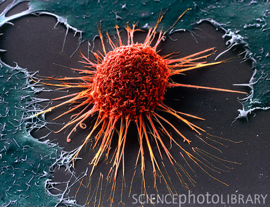 Cancer Cell