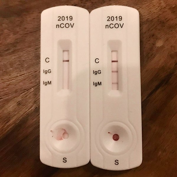 covid19 antibody test