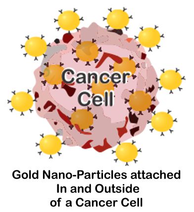 Cancerous Cell with Gold Nanoparticle with Anti-bodies on and in it.