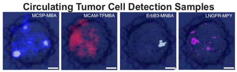 Circulating Tumor Cell Detection Samples