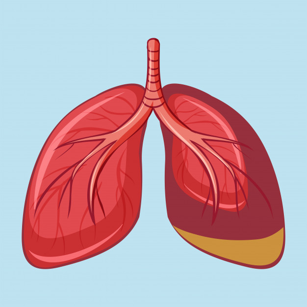 Mesothelioma lungs